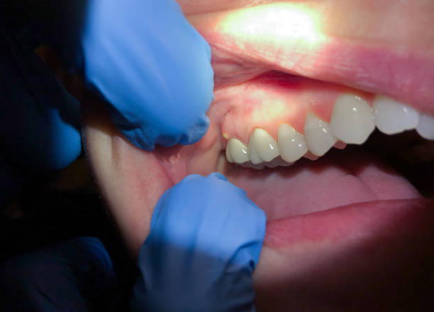 Best Broken or Cracked Tooth Emergency Dentist in Northview, MI