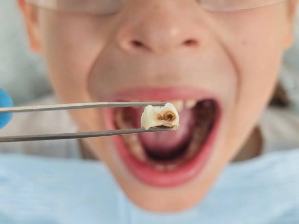 Best Emergency Dentist for Knocked-Out Tooth in Northview, MI