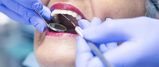 Best Emergency Dental Care for Abscessed Tooth in Northview, MI
